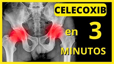 CELECOXIB 200 mg Para Qué Sirve Efectos Secundarios y mucho más