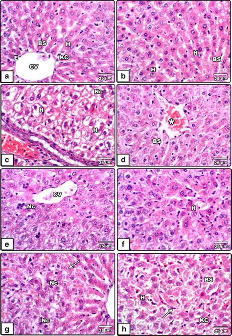 Ah Photomicrographs For Liver Sections Stained With Hematoxylin And Download Scientific