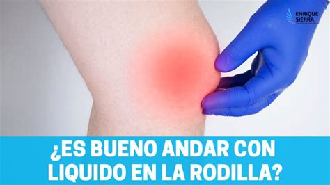 Es Bueno Andar Con L Quido En La Rodilla Fisioterapia