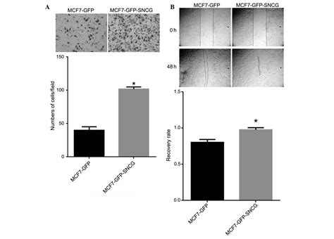 Synuclein γ Promotes Migration Of Mcf7 Breast Cancer Cells By