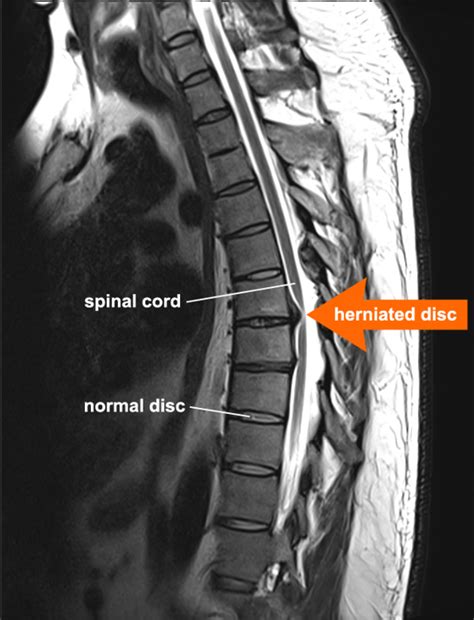 The Importance Of Getting An Mri After An Auto Accident — Louisiana