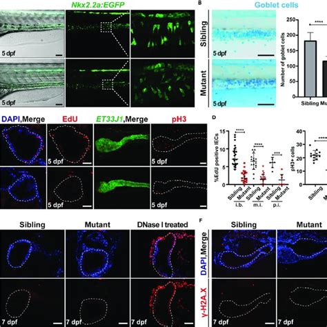 Ercc2 Xpd Deficient Intestinal Endothelial Cells Exhibit Loss Of Cell