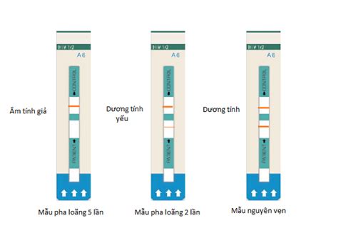 Kỹ thuật xét nghiệm test nhanh