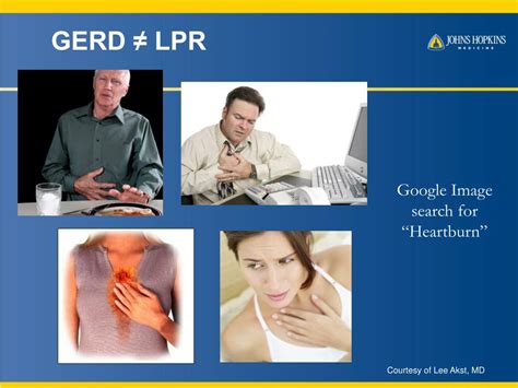 Ppt Laryngopharyngeal Lpr Reflux And Gerd Powerpoint Presentation