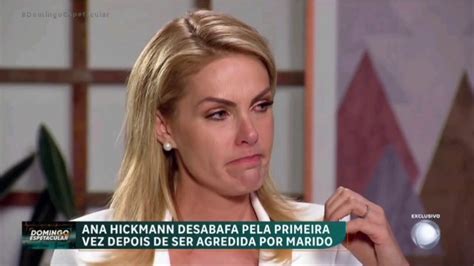 Em Entrevista Reveladora Ana Hickmann Detalha Agress O Do Ex Marido