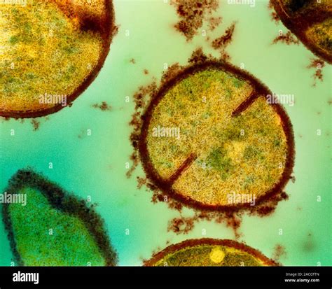 Staphylococcus Bacteria Coloured Transmission Electron Micrograph Tem Of Sectioned