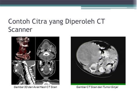 Ct Scan Andi Nuruljihad D Ppt Download