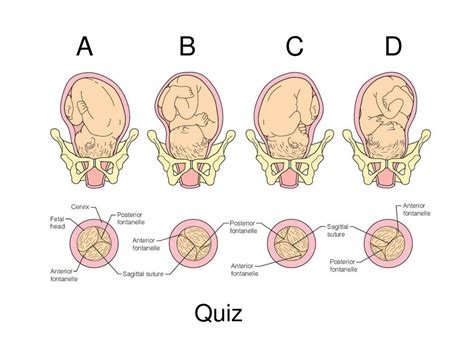 Ppt N 106 Labor And Delivery Powerpoint Presentation Free Download