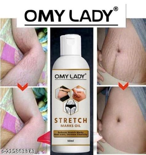 OMY LADY Present Repair Stretch Marks Removal Natural Heal Pregnancy