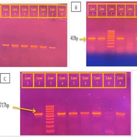 Ethidium Bromide Stained Agarose Gel Electrophoresis For Detection Of