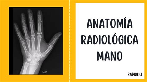 Anatomía Radiológica Radiología Convencional Mano Proyección