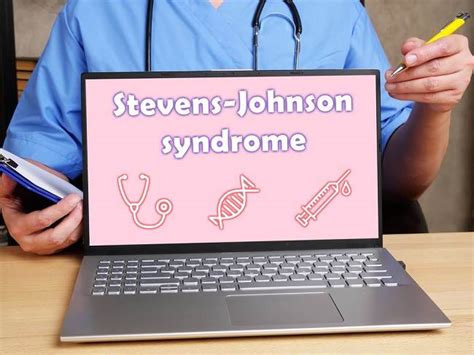 Sindrom Stevens Johnson Kenali Gejala Dan Penanganannya Alodokter