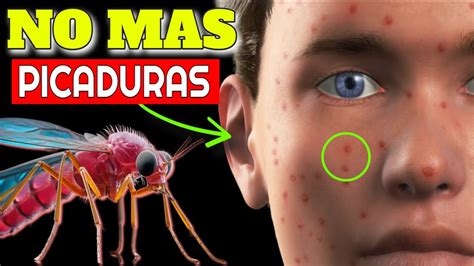 7 Increibles Métodos Para Que Nunca Más Te Piquen Los Mosquitos Youtube