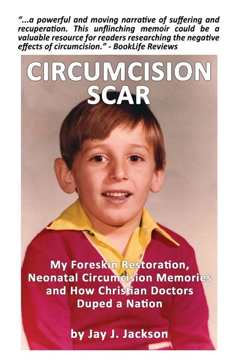 Circumcision Scar Ebook By Jay J Jackson Epub Rakuten Kobo United States