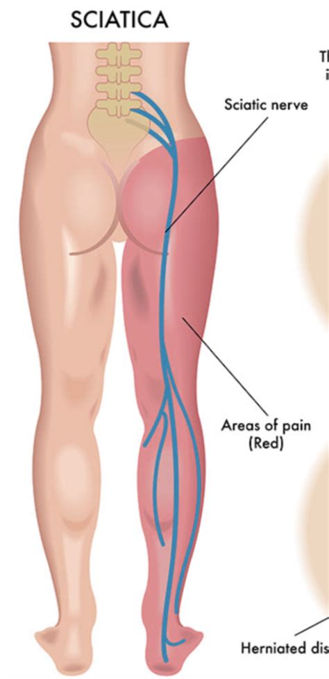 Faq Neurochirurgie De L Union Toulouse