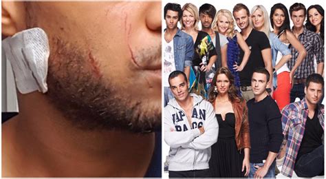 Secret Story Un Candidat Victime D Une Violente Agression Homophobe