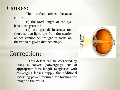 Defects Of Eye Class 10 Phy