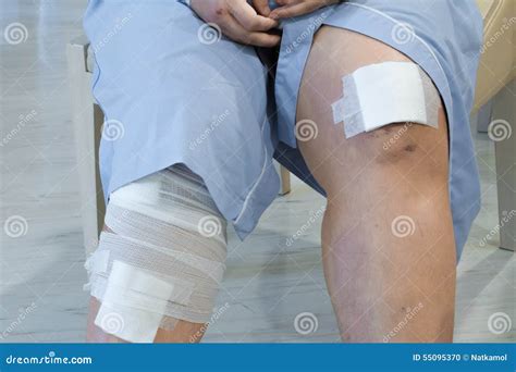 Knee With Adhesive And Gauze Bandage Stock Photo Image Of Knee