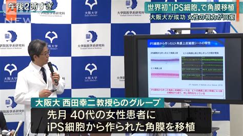 全球首例！日本成功移植「ips眼角膜」 40歲盲女恢復視力 Ettoday國際新聞 Ettoday新聞雲