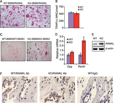 Critical Role Of Filamin Binding LIM Protein 1 FBLP 1 Migfilin In