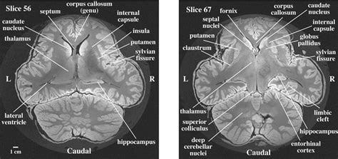 Brain of the African elephant (Loxodonta africana): Neuroanatomy from magnetic resonance images ...