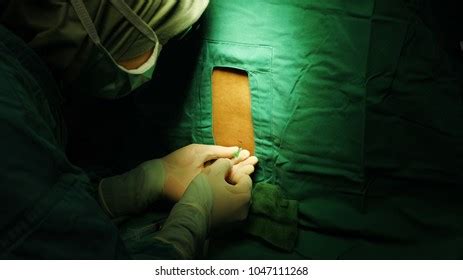 Anaesthetist Performing Spinal Anaesthesia Procedure Under Stock Photo ...