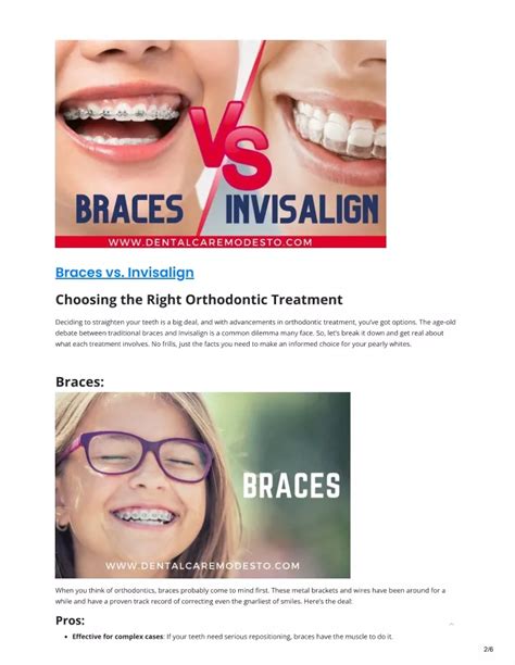 Ppt Braces Vs Invisalign Powerpoint Presentation Free Download Id