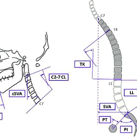 Schematic Of Measured Sagittal Alignment Parameters For The Cervical Download Scientific