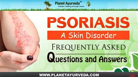 PPT - PSORIASIS - Frequently Asked Questions & Answers PowerPoint Presentation - ID:8388362