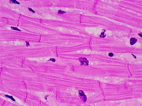 TBX20 Enhances Reprogramming Of Heart Fibroblasts Into Heart Muscle