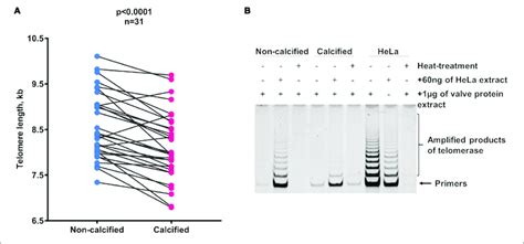 Telomere Length Dynamics In Different Areas Of The AS And Sclerotic