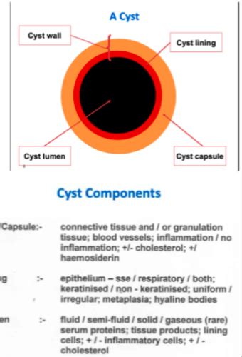 Cysts Of Jaws Odontogenic And Non Odontogenic Cysts Flashcards Quizlet