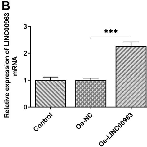 A The Expression Of Mir 320a In Diffuse Large B Cell Lymphoma Cell