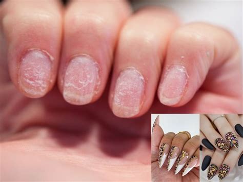 How To Fix Nails Damaged By Acrylics Nail Ftempo