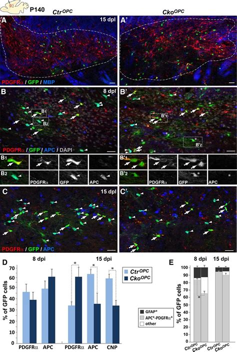 Ascl Mash Promotes Brain Oligodendrogenesis During Myelination And