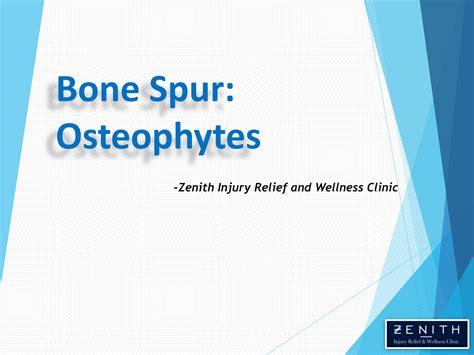 What Are Osteophytes And Its Causes And Treatment By Zenith Injury