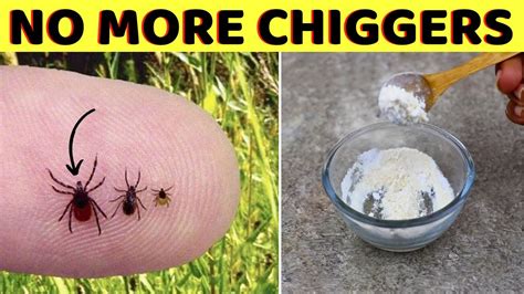 How to get rid of chiggers in your home and keep them away for good ...