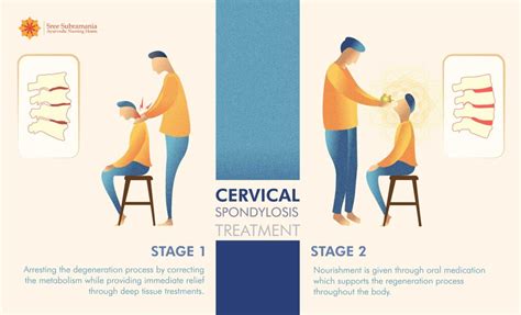 Cervical Spondylosis Physiotherapy Exercises