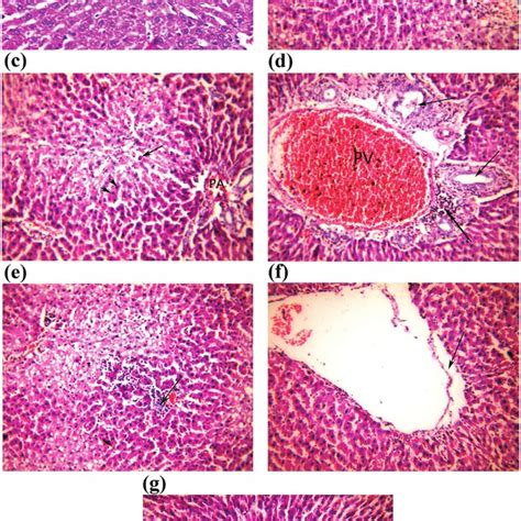 Photomicrographs Of Liver Sections Of Ccl 4 Treated Rats Administered