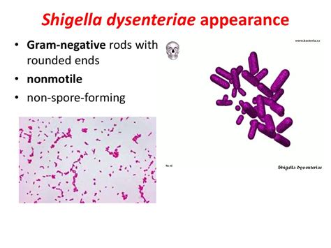 Shigella Dysenteriae Online Presentation