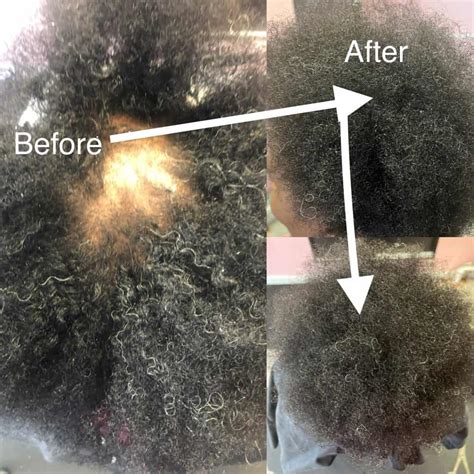 Photos – Hair Loss Salon