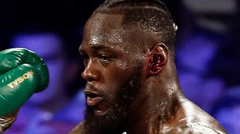 Deontay Wilder Insists Bleeding From The Ear Did Not Affect Him In