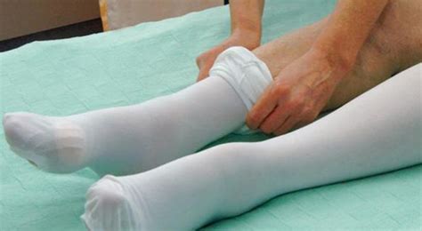 How Long Do Compression Socks Stay On After Surgery