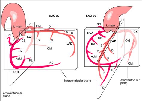 Coronary anatomy - PCIpedia