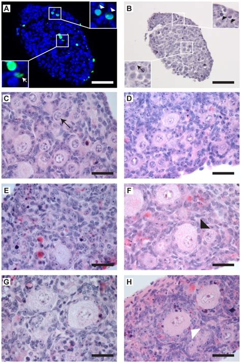 A B Tunel Analysis To Determine Apoptosis In Primordial Follicles