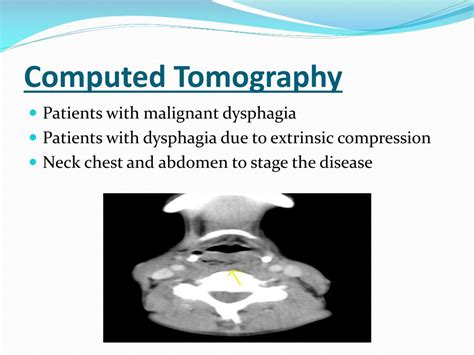 Ppt Management Of Dysphagia Powerpoint Presentation Free Download