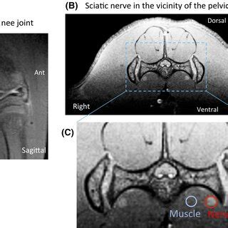 Sagittal Magnetic Resonance Images Of The Knee Joint A Axial Images