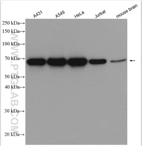 Hsp70 Antibody 10995 1 Ap Proteintech