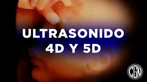 Ultrasonido 4D y 5D - Dr. Joshua Marriaga - YouTube