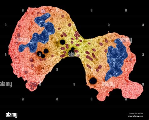 Cancer Cell Division Coloured Transmissionelectron Micrograph Tem Of